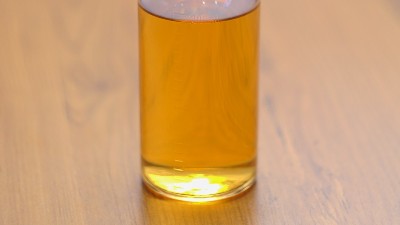 加酶洗衣粉中添加的是什么酶制剂