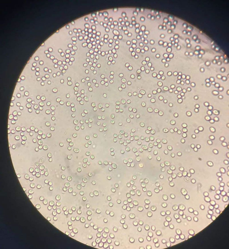 啤酒酵母细胞